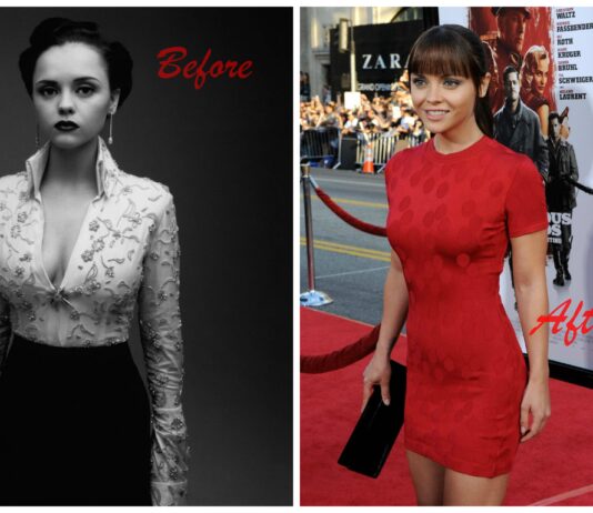 Christina Ricci Plastic Surgery – With Before And After Photos