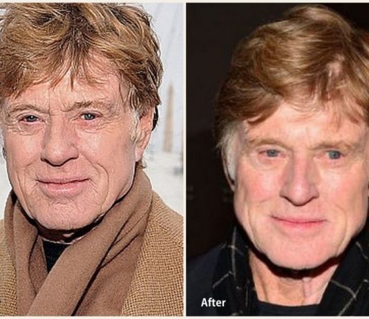 Robert Redford Plastic Surgery – With Before And After Photos robert redford cover