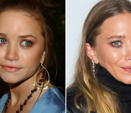 Elizabeth Olsen Plastic Surgery – With Before And After Photos