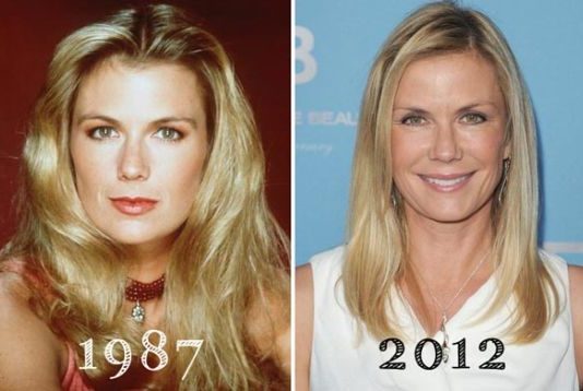 Katherine Kelly Lang Plastic Surgery – With Before And After Photos katherine kelly lang facelift
