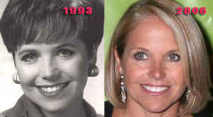 katie couric facelift