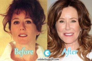 mary mcdonnell botox
