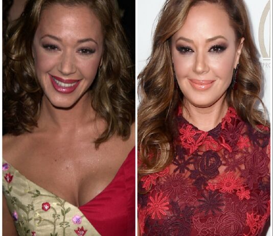 Leah Remini Plastic Surgery – With Before And After Photos