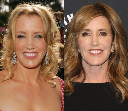 Felicity Huffman Plastic Surgery – With Before And After Photos