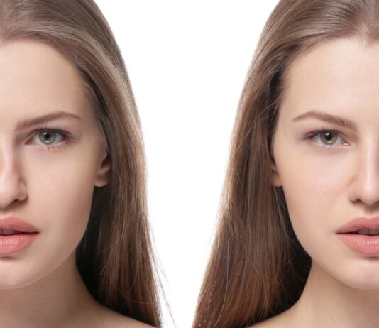 Revision Rhinoplasty: A Guide to Getting the Best Results