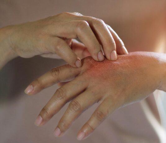 4 Common Pediatric and Adult Dermatological Conditions